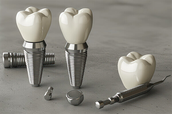 Implanty zębowe – czym są i jak działają?